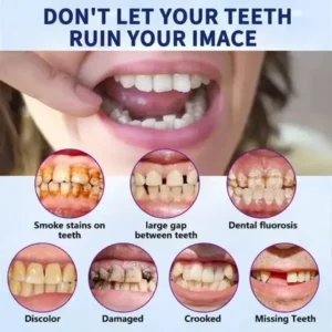 OHNEEN™ – 🦷Fortschrittliches Maßgeschneidertes Vollprothesen-Set🦷 (⏰Zeitlich begrenzter Rabatt⏰)